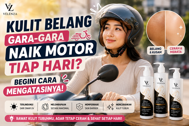 Kulit Belang Gara-Gara Naik Motor Tiap Hari? Begini Cara Mengatasinya